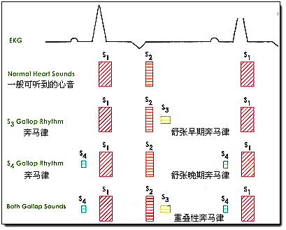 奔馬律|內科